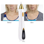 Mole & Wart Laser Remover